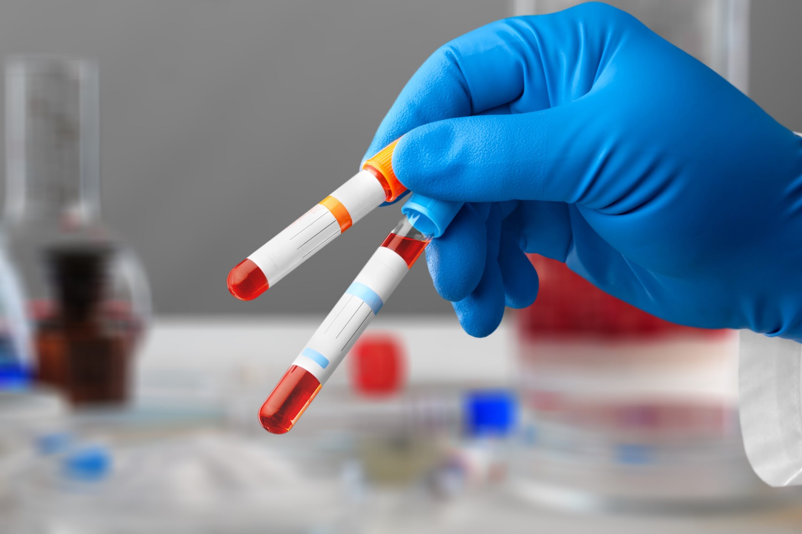 Mão com luva azul segurando dois tubos de coleta com amostras de sangue em um laboratório.